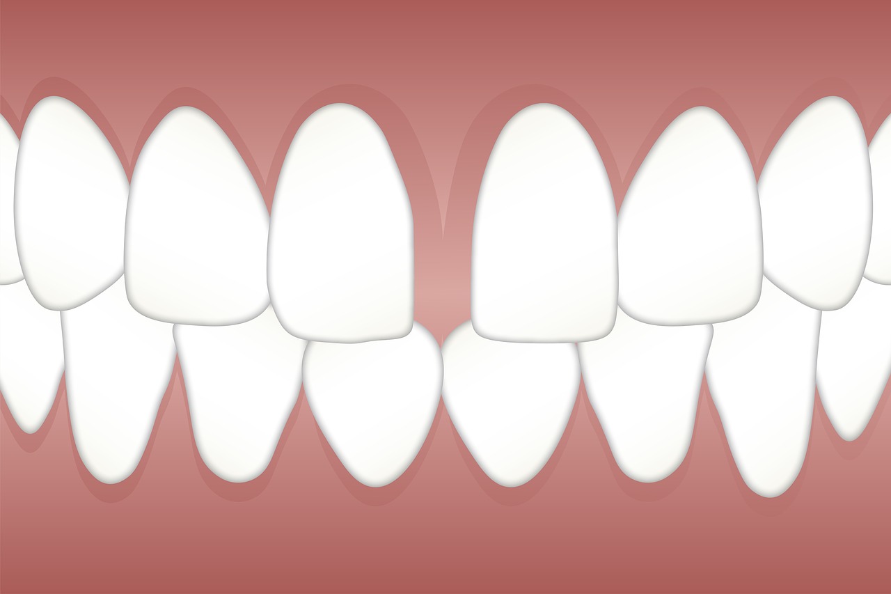 Dental Fillings Jackson MS, Tooth Filling Services