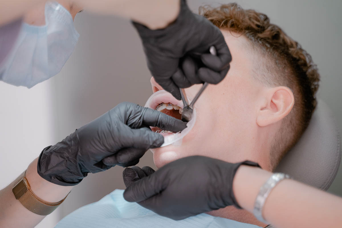 dentist installing lingual braces on patient