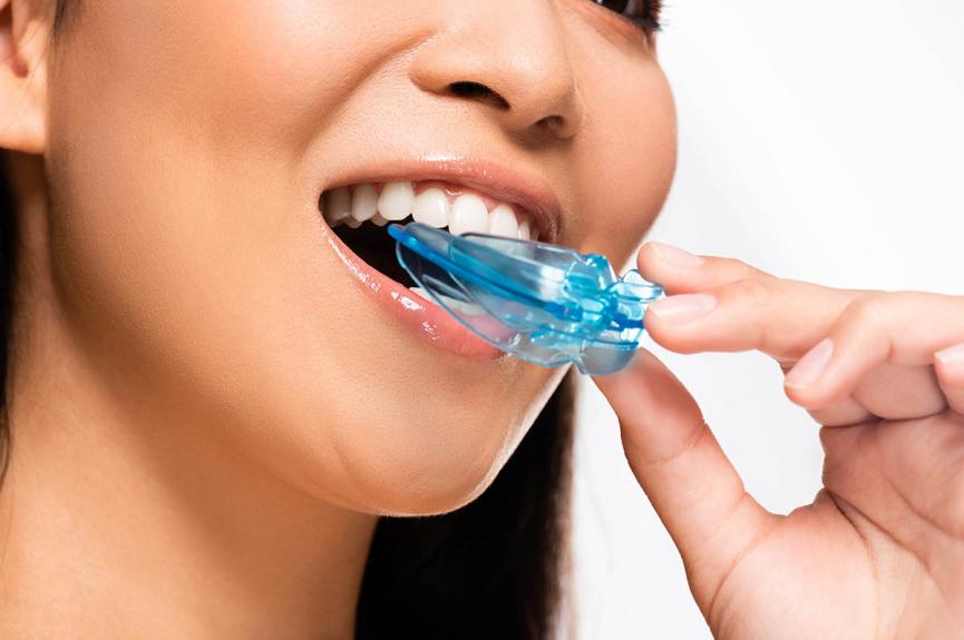 asian woman using mouth guard asian woman using mouth guard