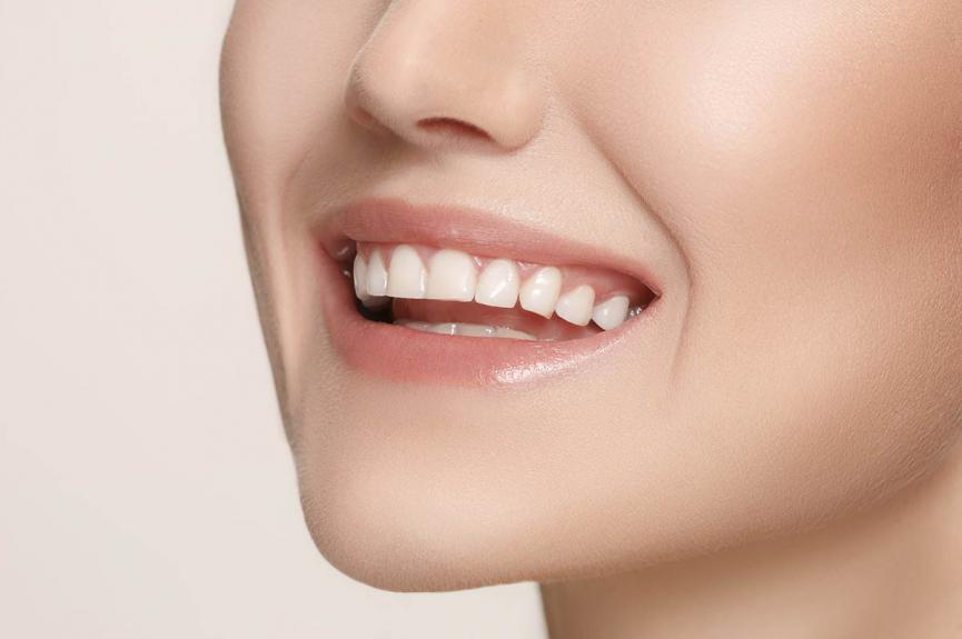 woman with perfect teeth smiling