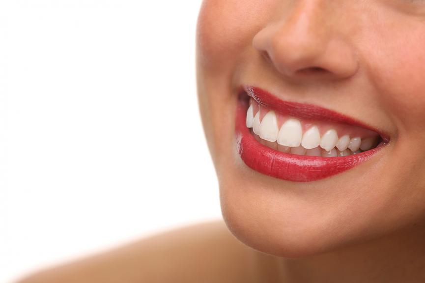 Beautiful smile Beautiful smile