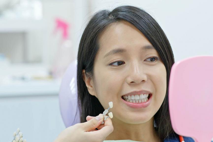 dentist showing veneers to patient dentist showing veneers to patient