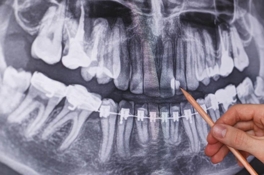 Doctor holding and looking at dental x-ray Doctor holding and looking at dental x-ray