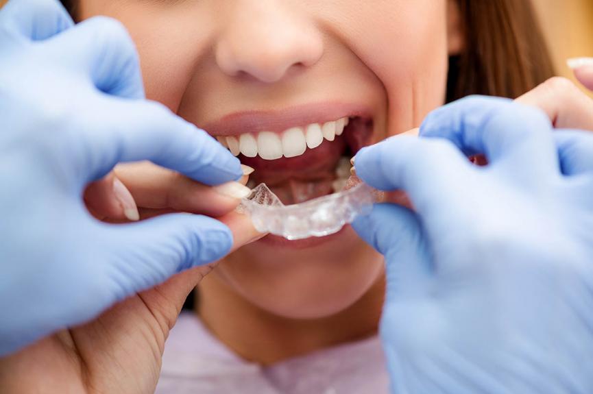 woman putting on invisible teeth aligners woman putting on invisible teeth aligners