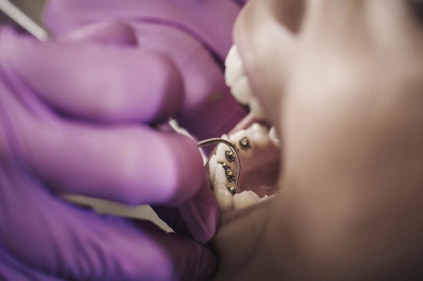 dentist checking patient's lingual braces dentist checking patient's lingual braces