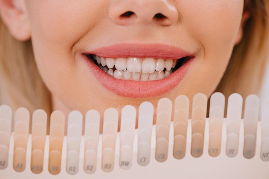 Home Teeth Whitening Kits in Singapore Reviews Dentaleh
