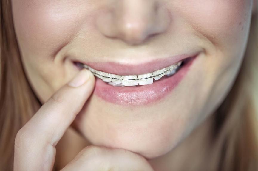teenager wearing braces for teeth straightening teenager wearing braces for teeth straightening