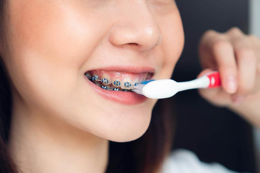 woman with braces brushing teeth woman with braces brushing teeth