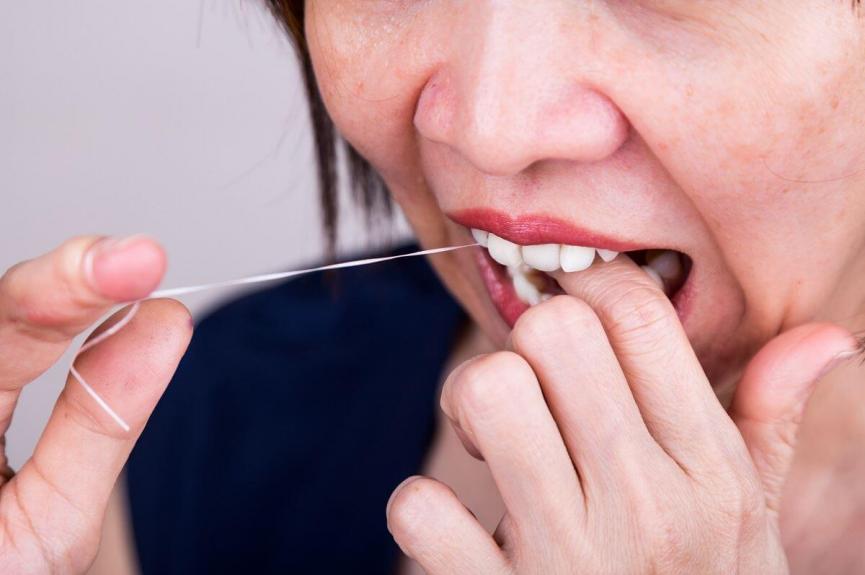 Dental Floss Singapore Flossing Teeth Benefits Dentaleh