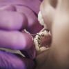 dentist checking patient's lingual braces