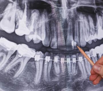 Doctor holding and looking at dental x-ray