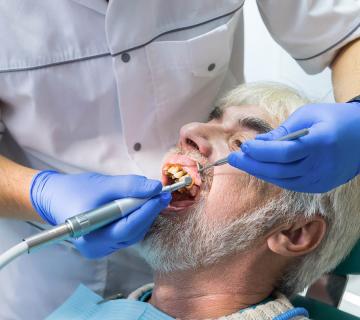 senior man getting teeth tartar cleaning treatment
