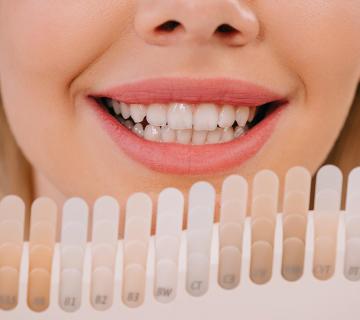smiling woman holding teeth whitening colour palette