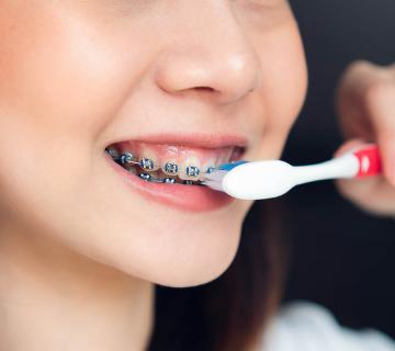 woman with braces brushing teeth