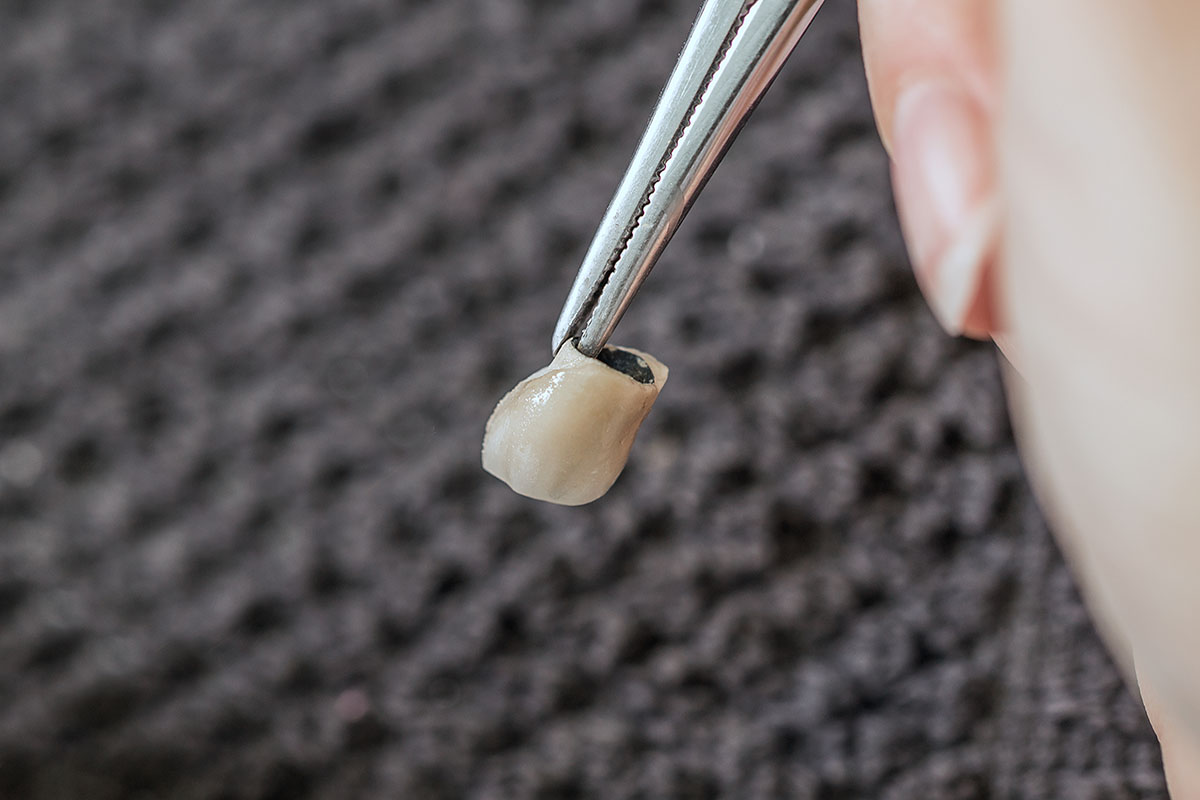 dental technician holding a crown with an instrument